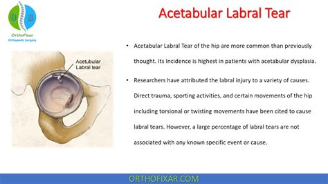 acetabular labral tear orthopedic test|acetabular labral tear surgery.